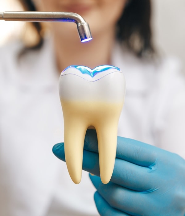 dental-fillings-wesbrook-village-dental-centre
