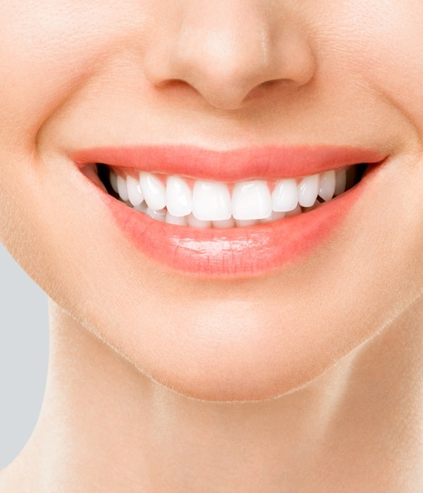 teeth-whitening-wesbrook-village-dental-centre