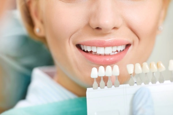 teeth-whitening-wesbrook-village-dental